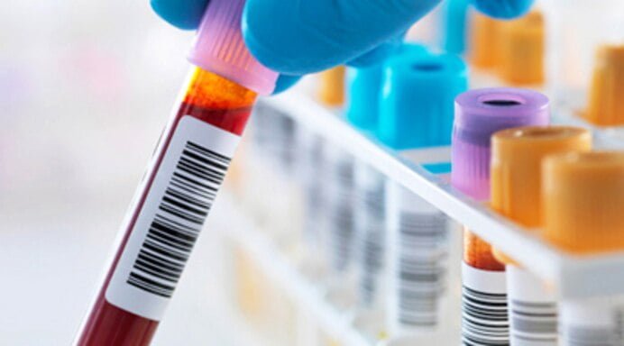 Find Labs Blood Test